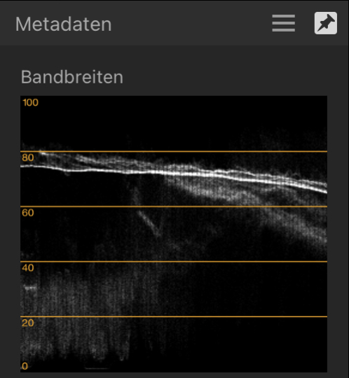 Das Diagramm "Bandbreite" und ein Foto