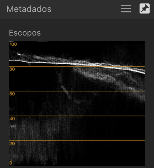 Foto e gráfico de Escopo